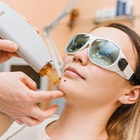 Hormone-related skin changes and mole treatment Ottawa