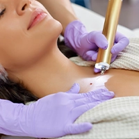 Ottawa dermatologist for genetic skin formations