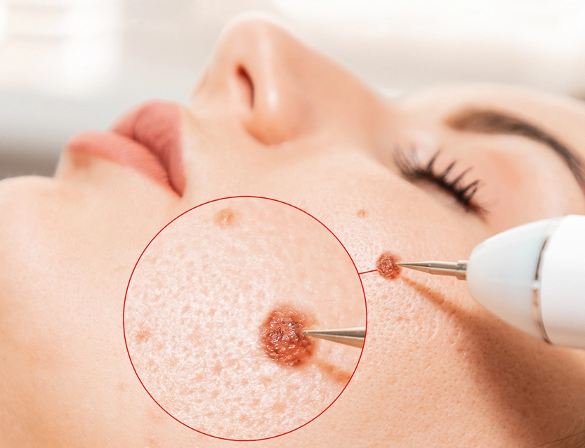 Top-rated cosmetic procedure clinics in Ottawa