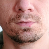 Top-rated Ottawa lip filler clinics